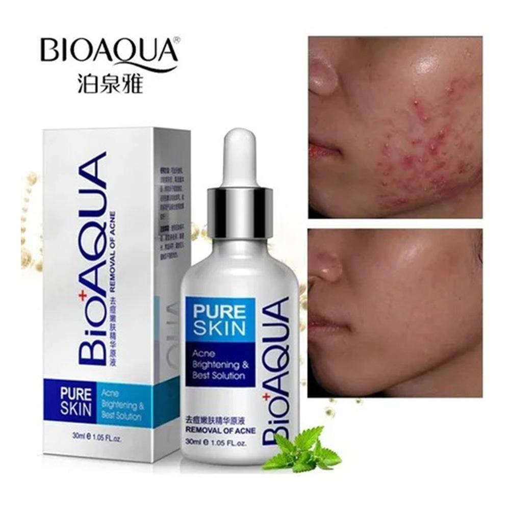 Serum Facial Antiacne Bioaqua